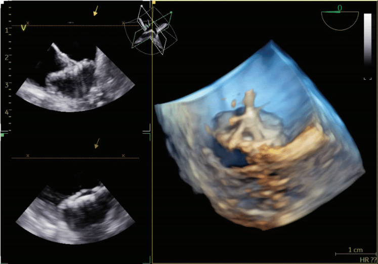 Weisman - Fig 5 - Oct 2024