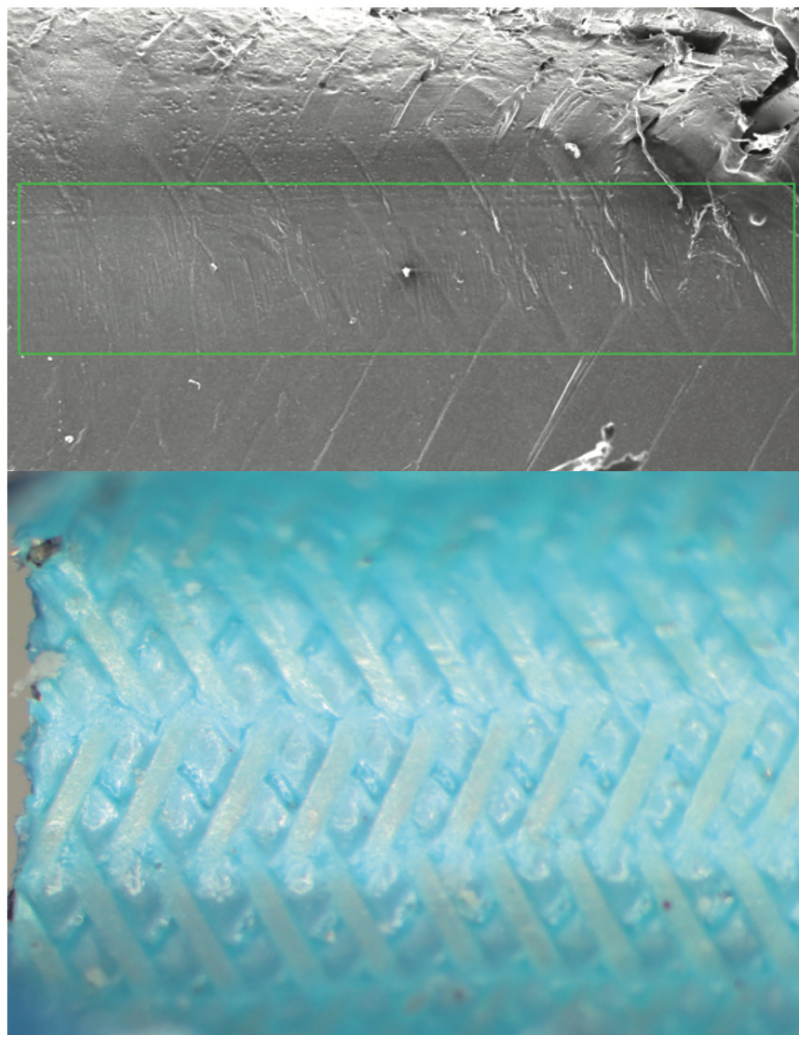 Whitbeck Glide Assist Figure 2