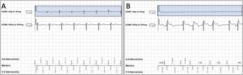 Willett-Fig1-EPLD-Sept 2025.png 