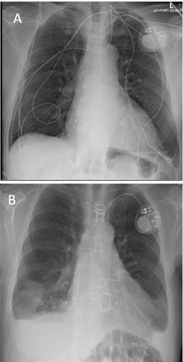 Willett-Fig3-EPLD-Sept 2025.png 