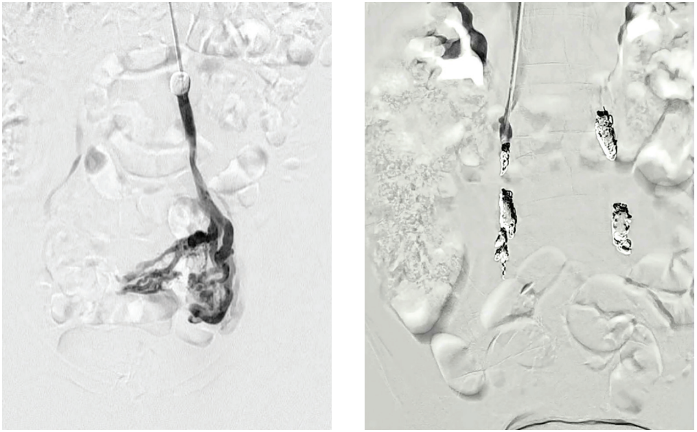 Winokur-Fig1-CLD-MarchApril 2026