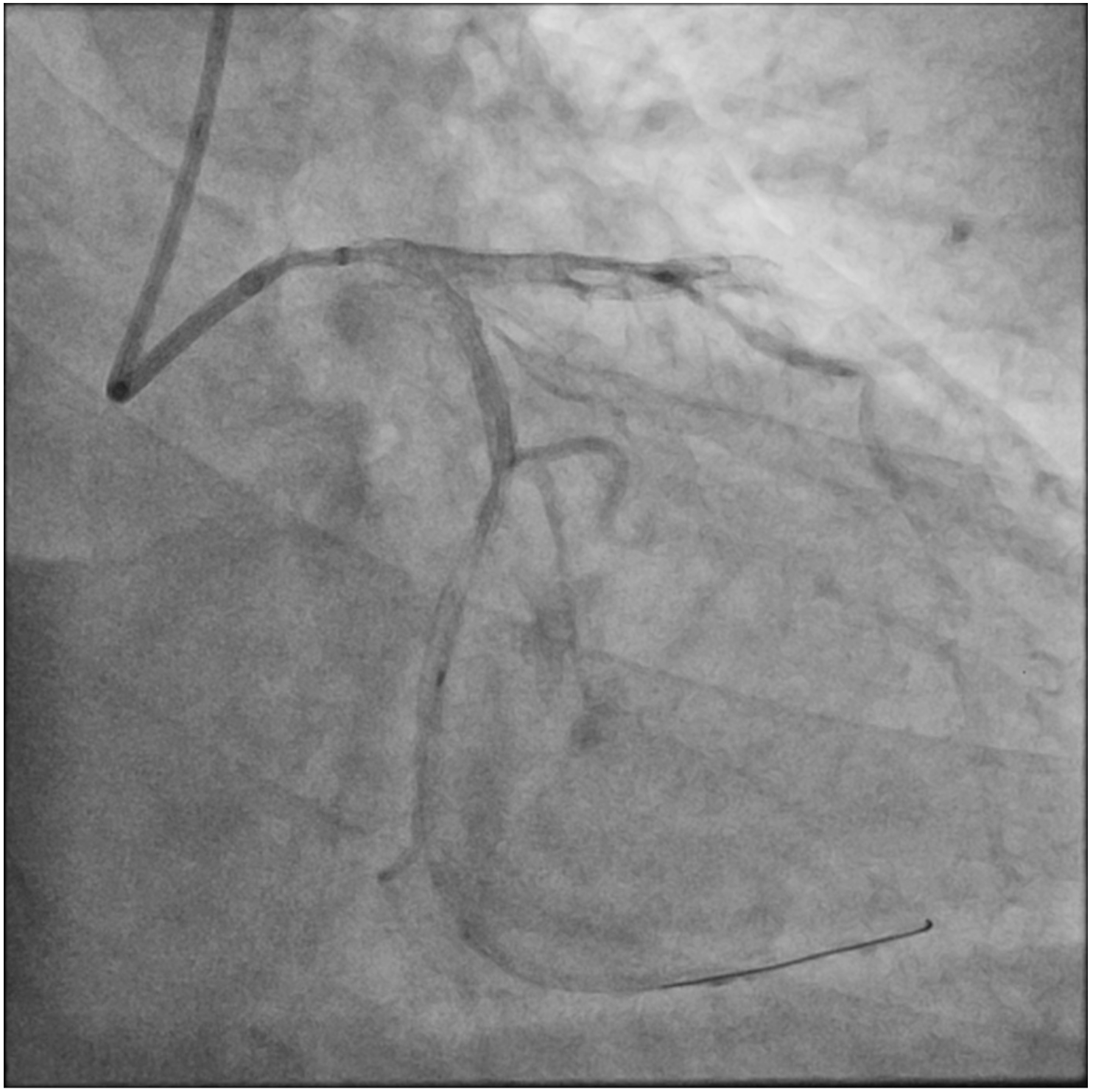 Figure 1.  (F) Angiography  