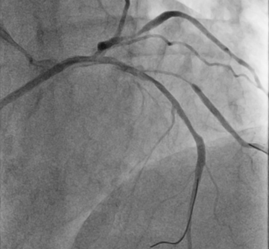 Figure. (D) Successful rewiring. 