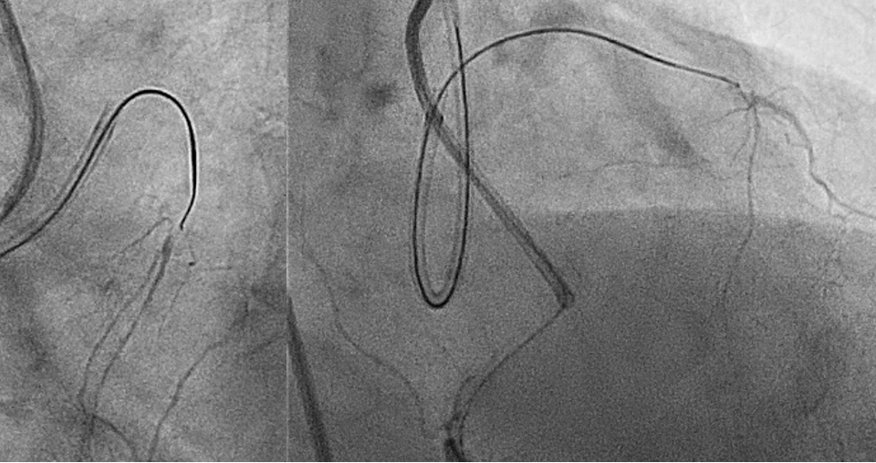 Figure 3. (A) The far view 