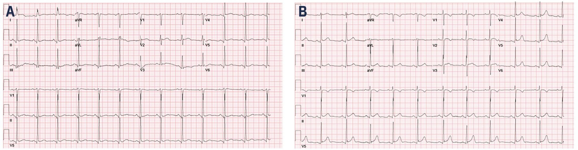 Wu Venous Access Figure 1