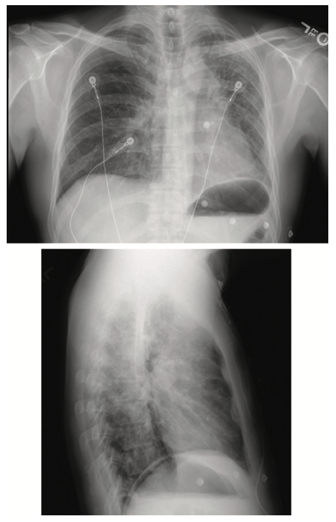 Wu Venous Access Figure 2