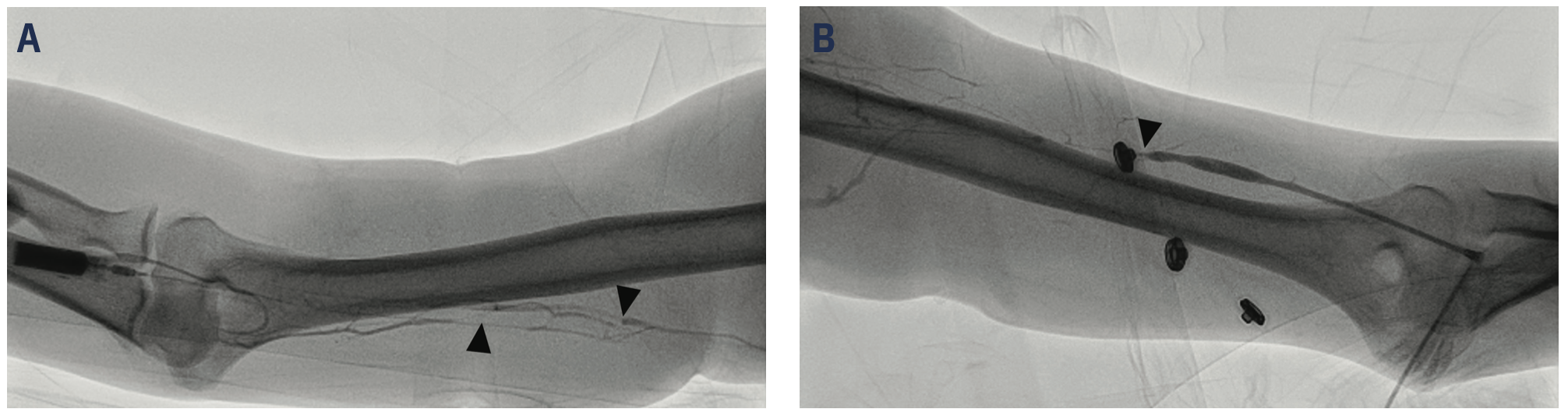Wu Venous Access Figure 4