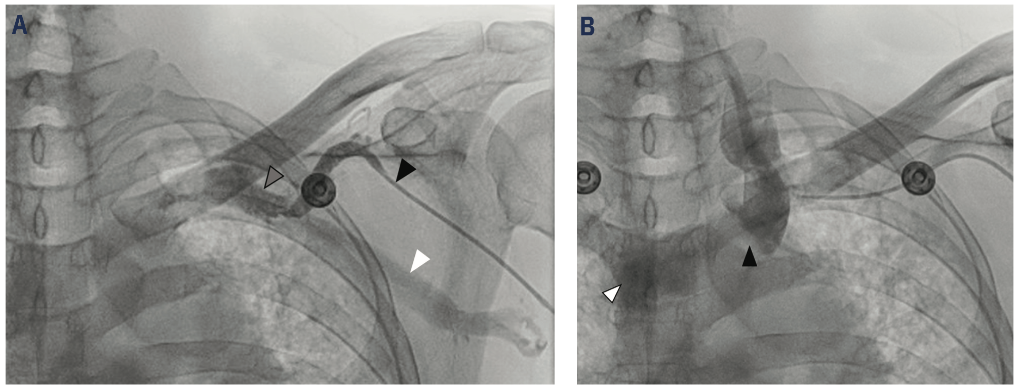 Wu Venous Access Figure 5