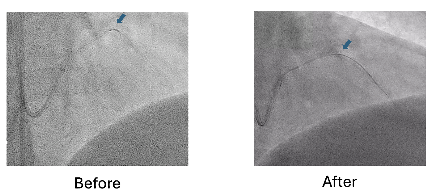 Figure 7. Fluoroscopy