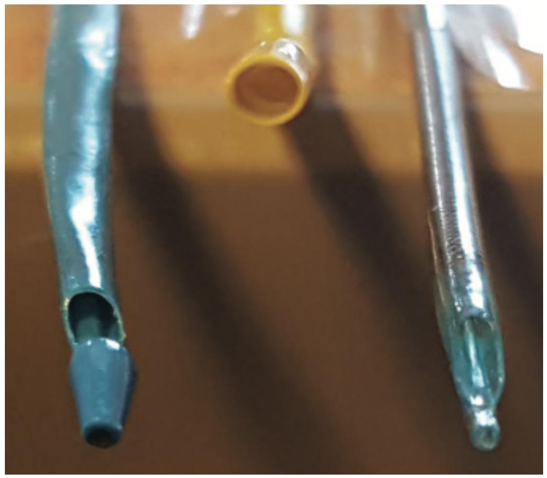 Yee Thrombectomy Figure 7
