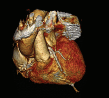 Yoakum Fig 2 Dec 2024 
