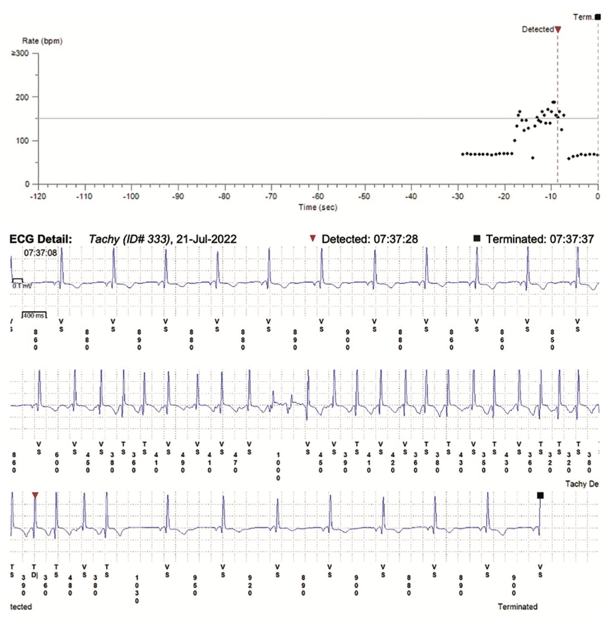 Zeroka Cardiac Implantable Figure 1