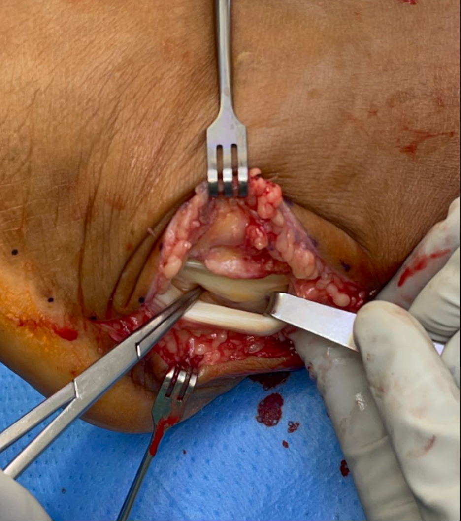 Intraop pathology