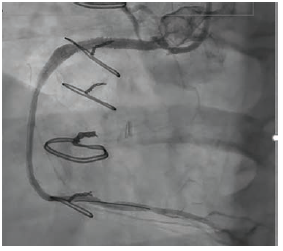 case 3 fig 3.png 