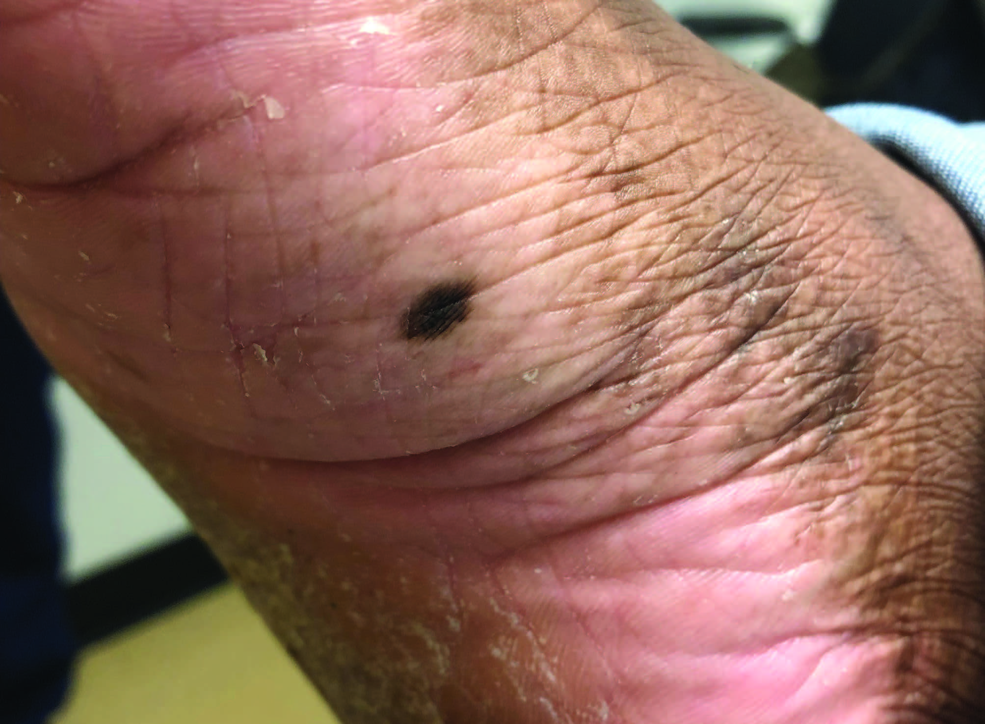 top 10 skin conditions