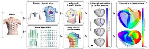Workflow of volumetric ECGI technology developed by Corify