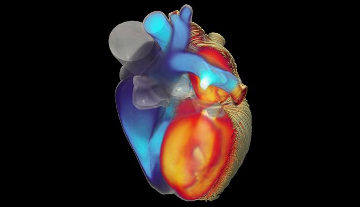 iHeart Simulator