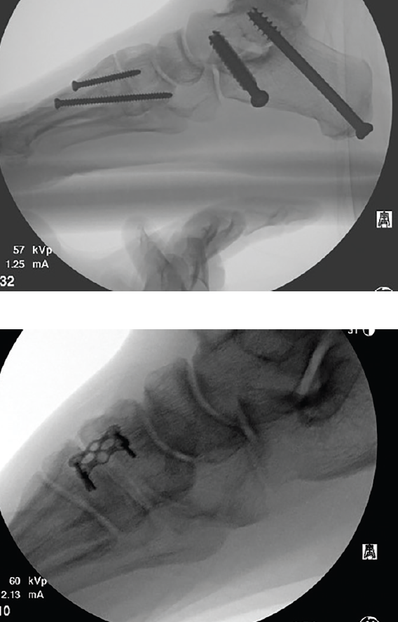 Above see examples of a wide (top) versus a narrow (bottom) intraoperative field of view. Each option carries unique advantages and drawbacks.