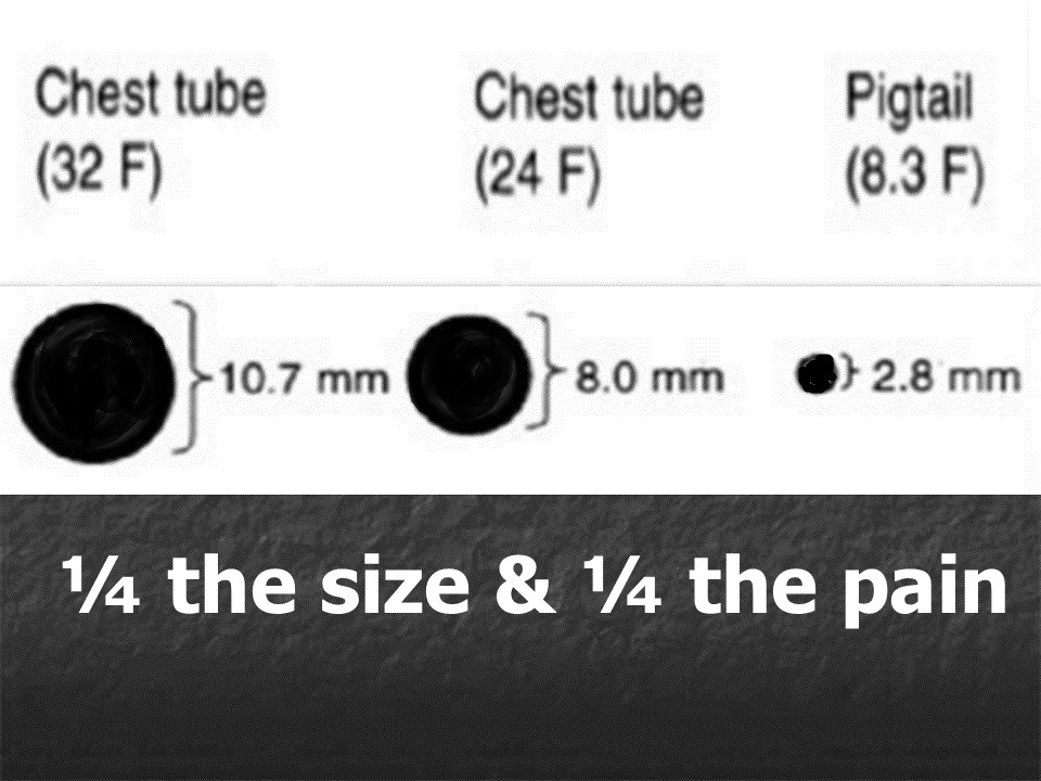 pigtail rule of thumb