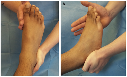 Photo of the neutral heel lateral push test. (Photos courtesy of Chandra Pasapula M.D.)