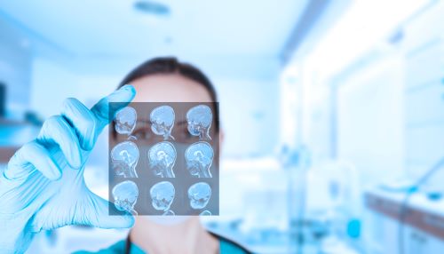 doctor looking at brain scans