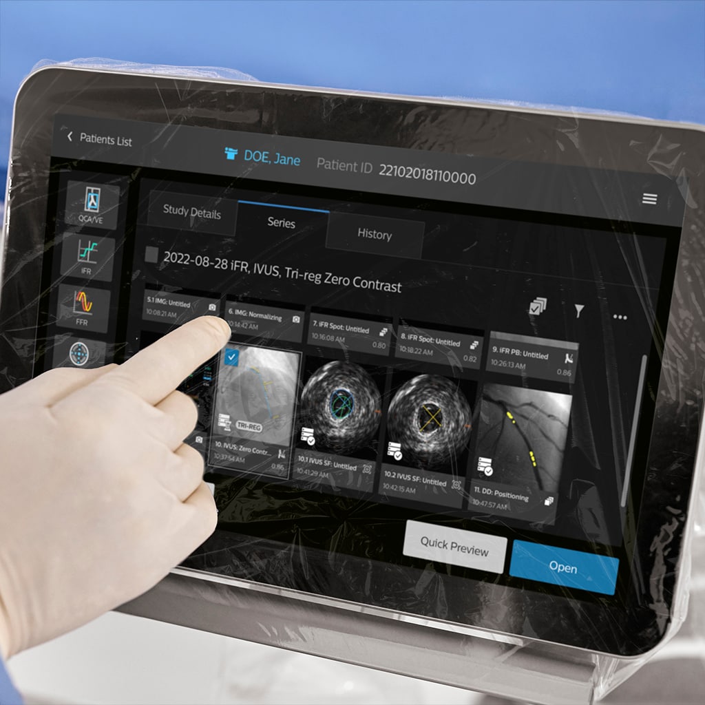 IntraSight Plus Viewing Screen