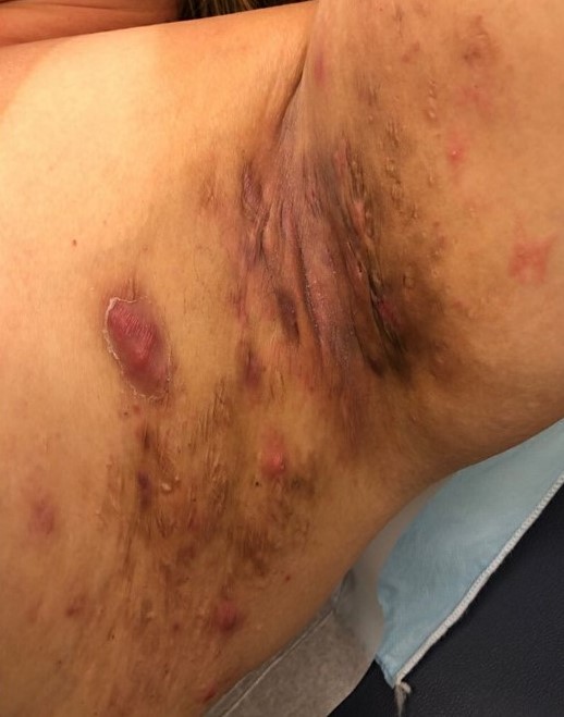 Photo courtesy of HSF.