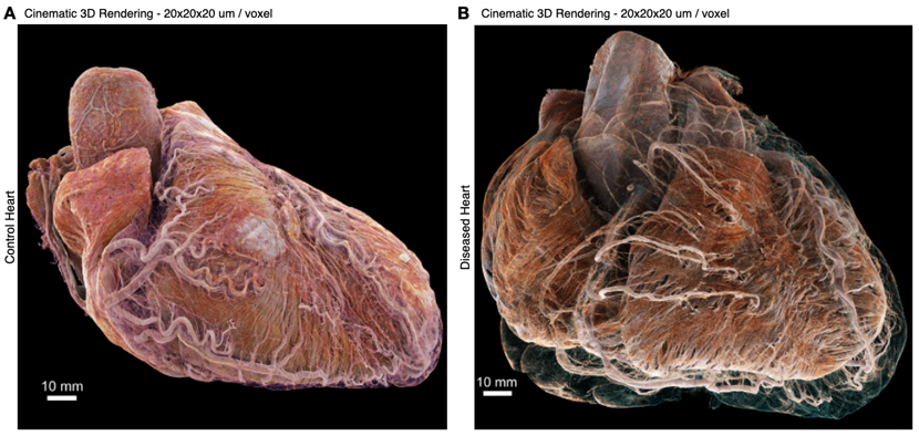 3D cinematic rendering of the heart