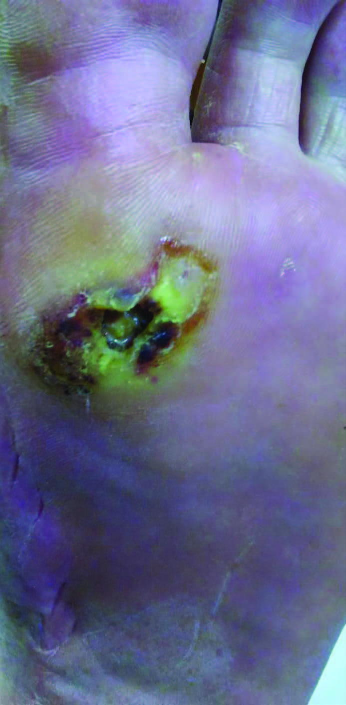 The panelists agree that available technology can help improve wound dimension measurement, in addition to providing valuable information relevant to healing potential, progress to closure, and other important metrics.