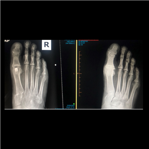 Figure 14