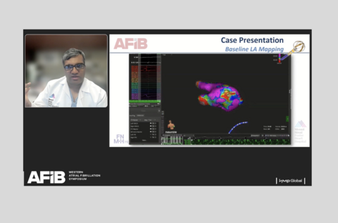 Western AFib Live Case 2 new