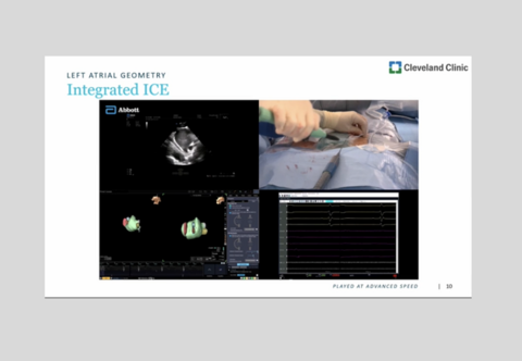 Western AFib Live Case 3
