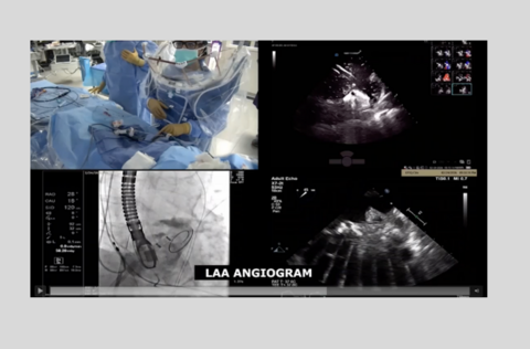 Western AFib Live Case 4