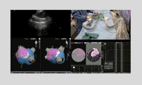 Western AFib Live Case 6