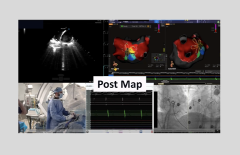 Western AFib Live Case 7