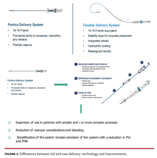 Differences between old and new delivery: technology and improvements.
