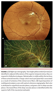 Right eye retinography.