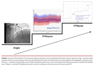 Clinical Utility of Novel Fractional Flow Reserve Pullback for Individual Lesion Contribution in Serial Disease