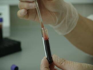 blood in test tube