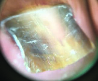 Photo courtesy of Tracey C. Vlahovic, DPM