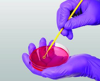 Biofilm And DFUs: What The Literature Reveals