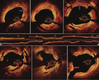  Vijayvergiya JIC OCT