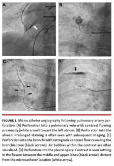 Steinberg - Figure 1