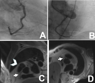 Al-Mubarek - Preview