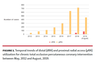 Nikolakopoulos - Distal Radial Access