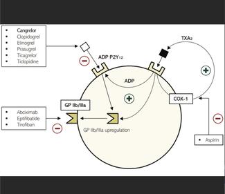 Mehta Cangrelor thumbnail