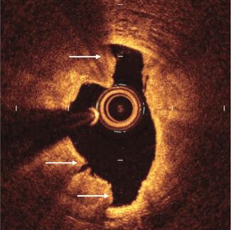 Shlofmitz treatment algorithms thumbnail