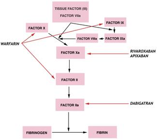 Moulton Stroke Prevention thumbnail