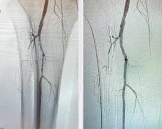 Chapman CLD Oct 2021