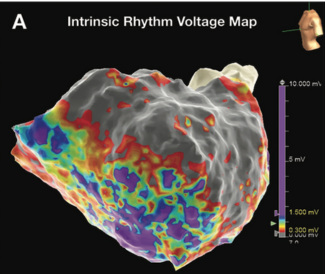Collinson Tachycardia thumbnail